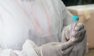 Cenário epidemiológico da Covid-19 no Amazonas é divulgado pela FVS-RCP, nesta terça-feira (30/11)