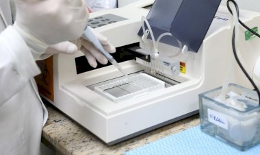 Novo Balanço da Covid-19 no Amazonas é atualizado   pela FVS-RCP, nesta terça-feira (11/01)