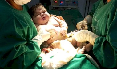 Em maternidade de Parintins, SES-AM registra o nascimento do maior bebê do Amazonas